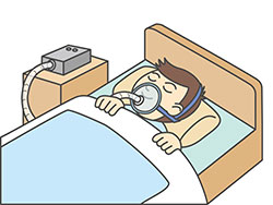 CPAP